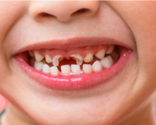 pediatri-dentistry-category pediatri-dentistry-category
